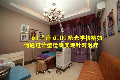 🌳 痤 🐟 疮光学祛痘如何通过分型检测实现针对治疗